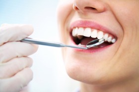 Trattamenti non invasivi - C.D.M. Dentalmedica srl